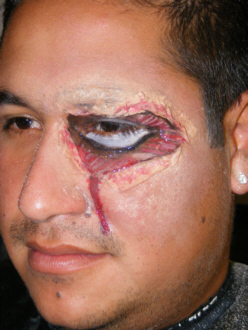 a clsoe up of the Skined Eye Effect, hand built skin peel with two dimensional makeup around eye